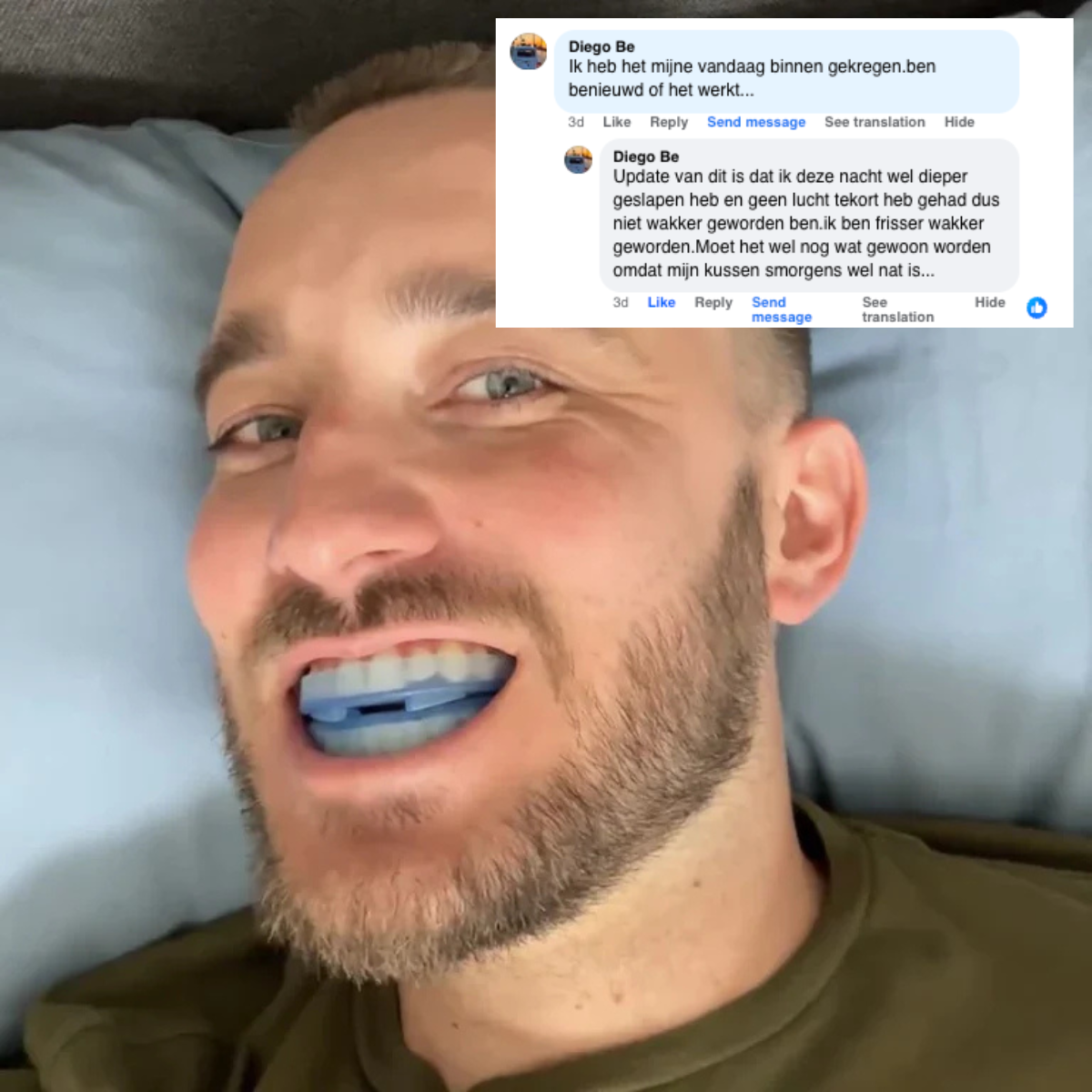 Het Stille Anti-Snurk Mondstuk